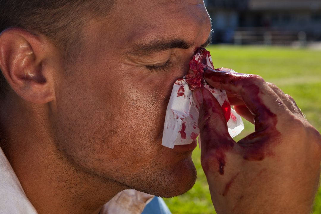 rugby face injuries