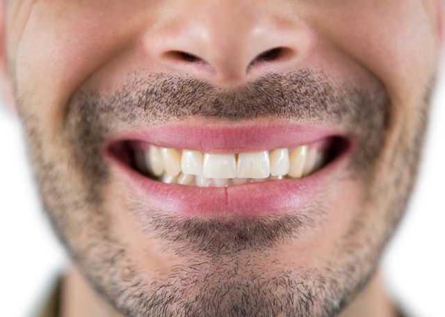 Man showing his teeth - Download Free Stock Photos Pikwizard.com