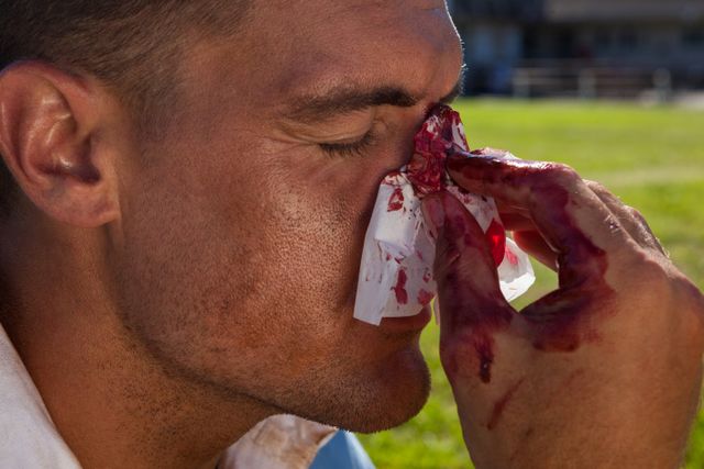 Close up of rugby player with injured nose - Download Free Stock Photos Pikwizard.com