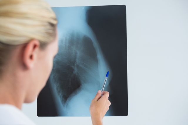 Cropped image of female doctor examining X-ray - Download Free Stock Photos Pikwizard.com