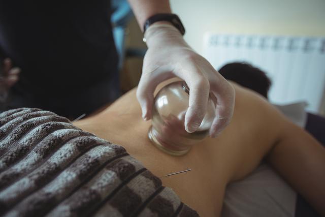 Mid section of therapist giving cupping therapy to man in spa